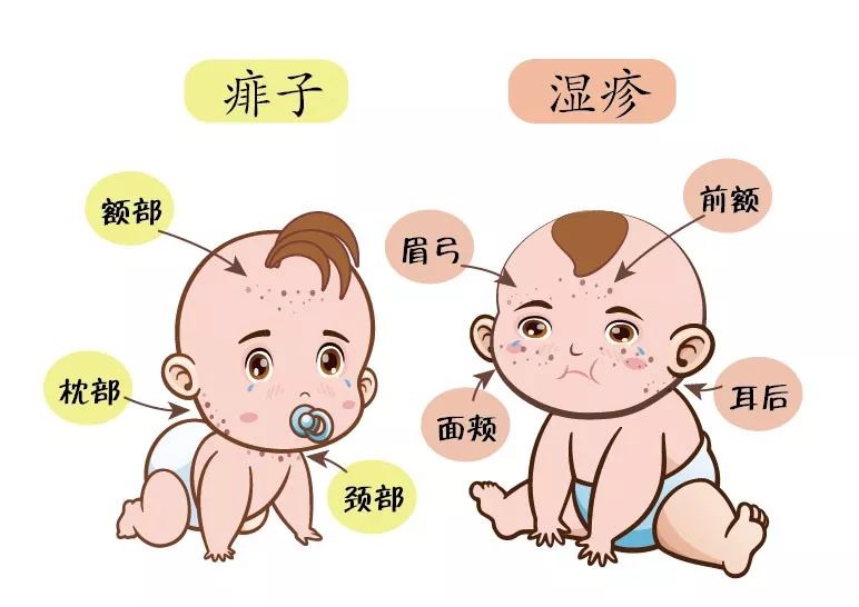 宝宝热的头上长痱子,天热长痱子擦什么最好用