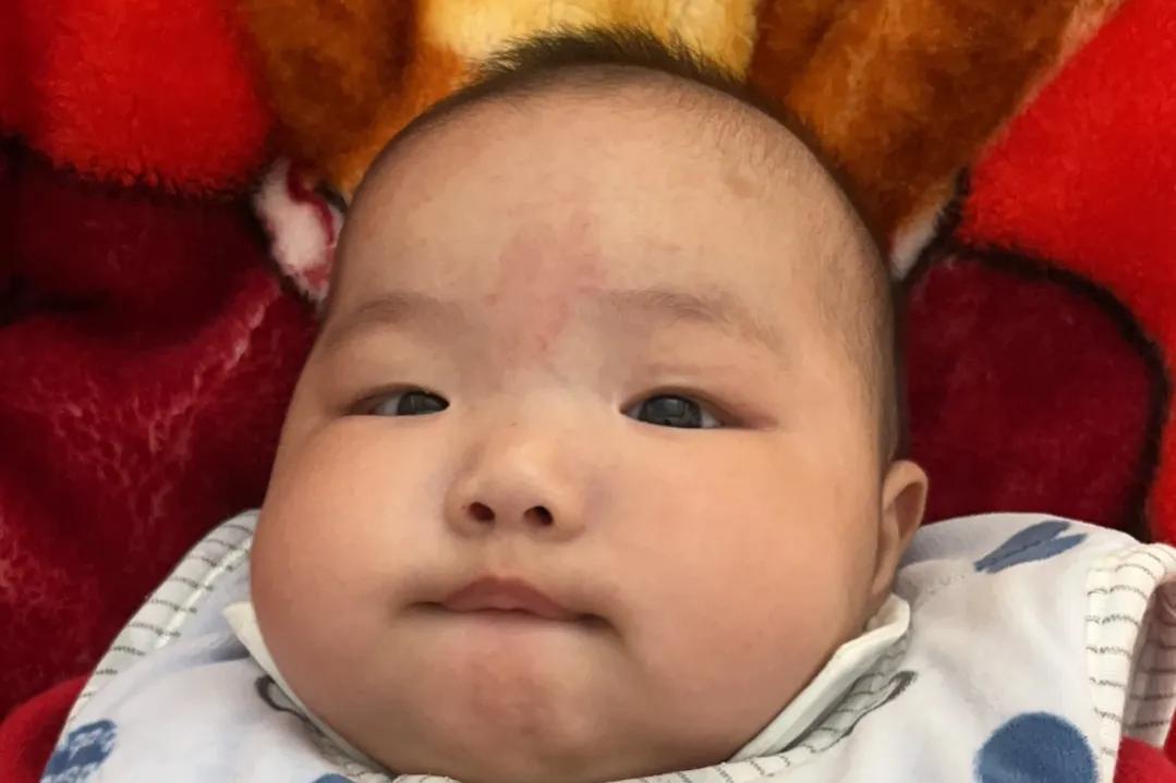 我家宝宝手上有胎记,宝宝身上有个胎记模糊不清