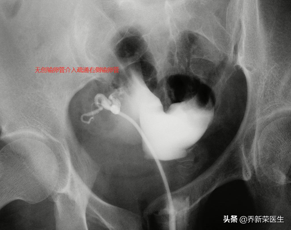 缁у彂鎬т笉瀛曡緭鍗电鍫靛,33宀佸弻渚ц緭鍗电鍫靛骞胯タ