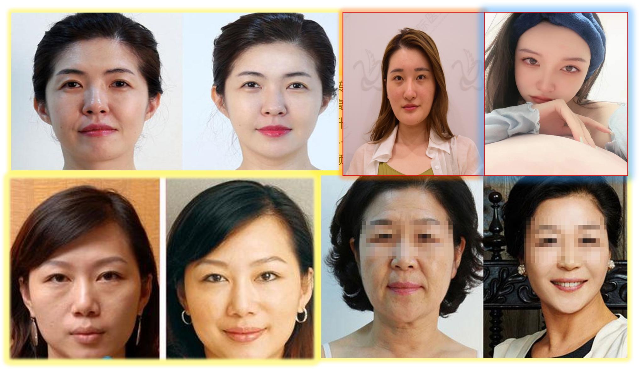 海博医美在哪里,海博医美集团