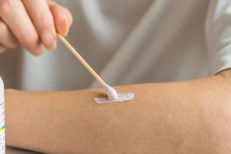 长个疖肿怎么消下去,长了小的疖肿会自行消退吗