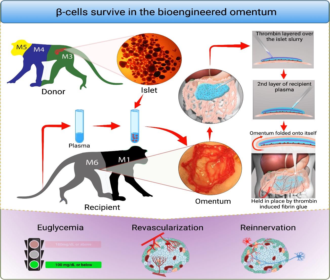 突破糖尿病治疗，哈佛大学工程化建造“内分泌胰腺”！听听市二医院专家解读
