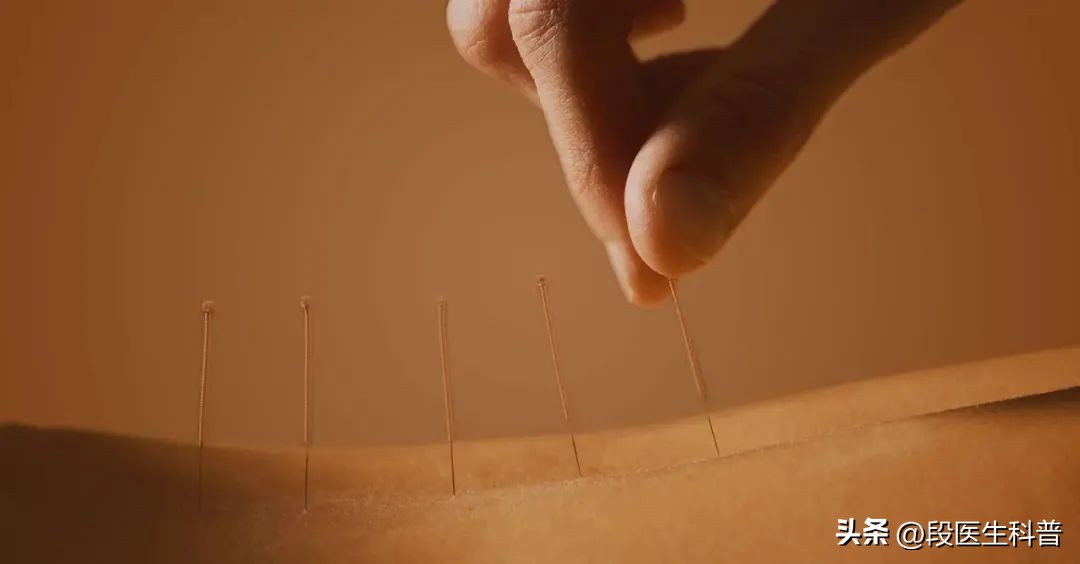 急性腰扭伤针灸什么穴位,急性腰扭伤针灸穴位图