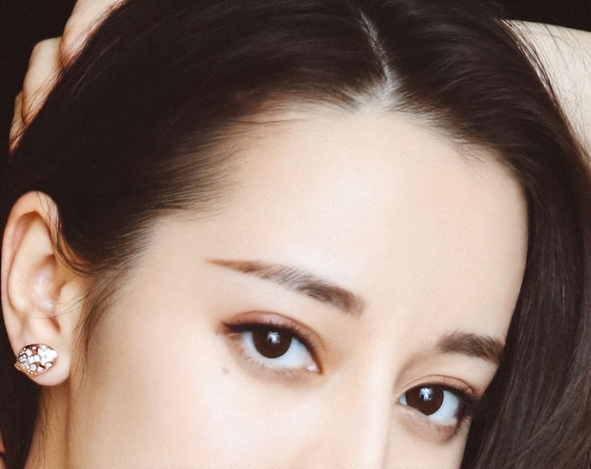 全切双眼皮开眼角7天内注意事项,三点一线双眼皮开眼角后注意事项