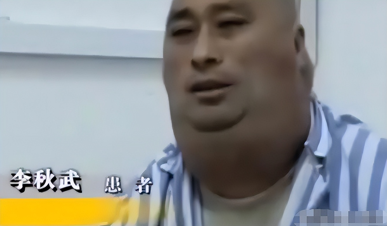 男子一年喝一千斤酒膀子像河马,男子喝酒脖子变河马脖