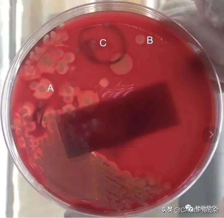 2017版医疗器械分类目录对照表,17年医疗器械分类目录21类