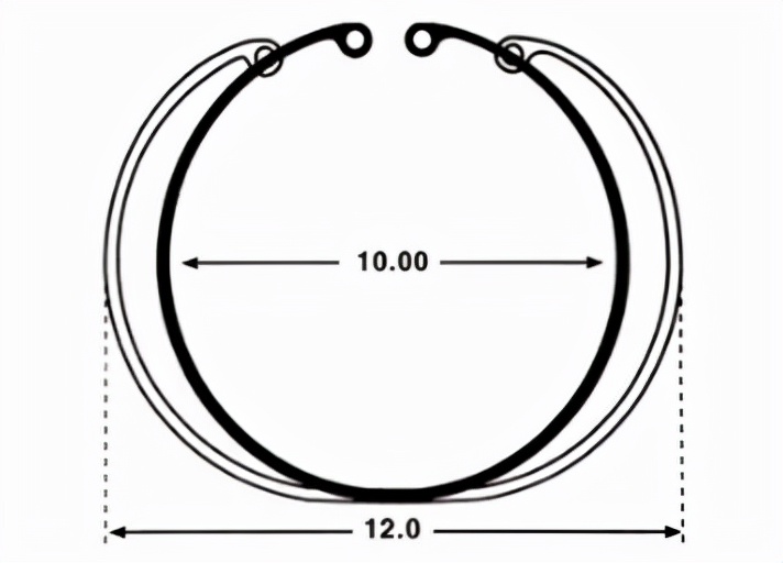 囊袋张力环的选择,囊袋张力环与预装式张力环