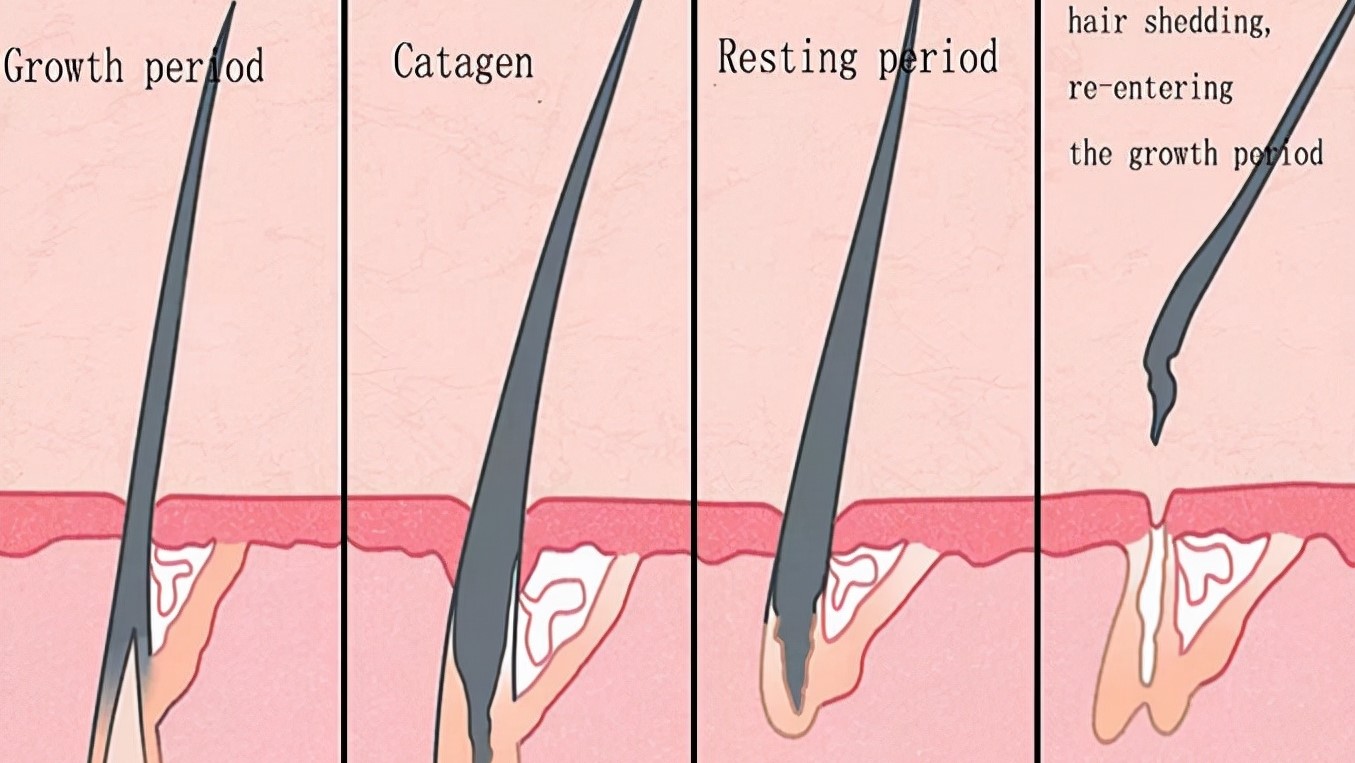 好奇发型怎么理的,头发自然卷毛怎么自己长直发