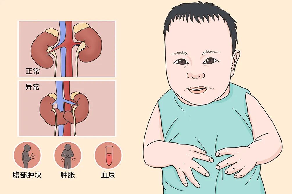 西安大兴医院：血管炎+“马蹄肾”，一场14岁少年的跨省救援