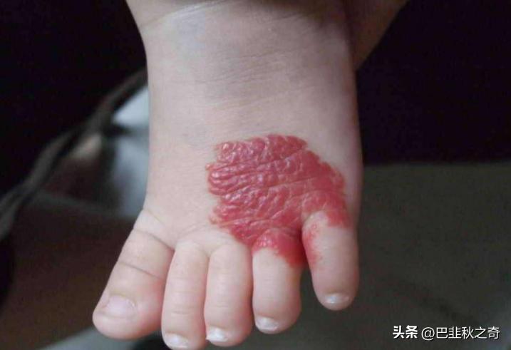 因祖传中医秘方，实控人摇身一变行业专家，长峰医院被烧“火”了