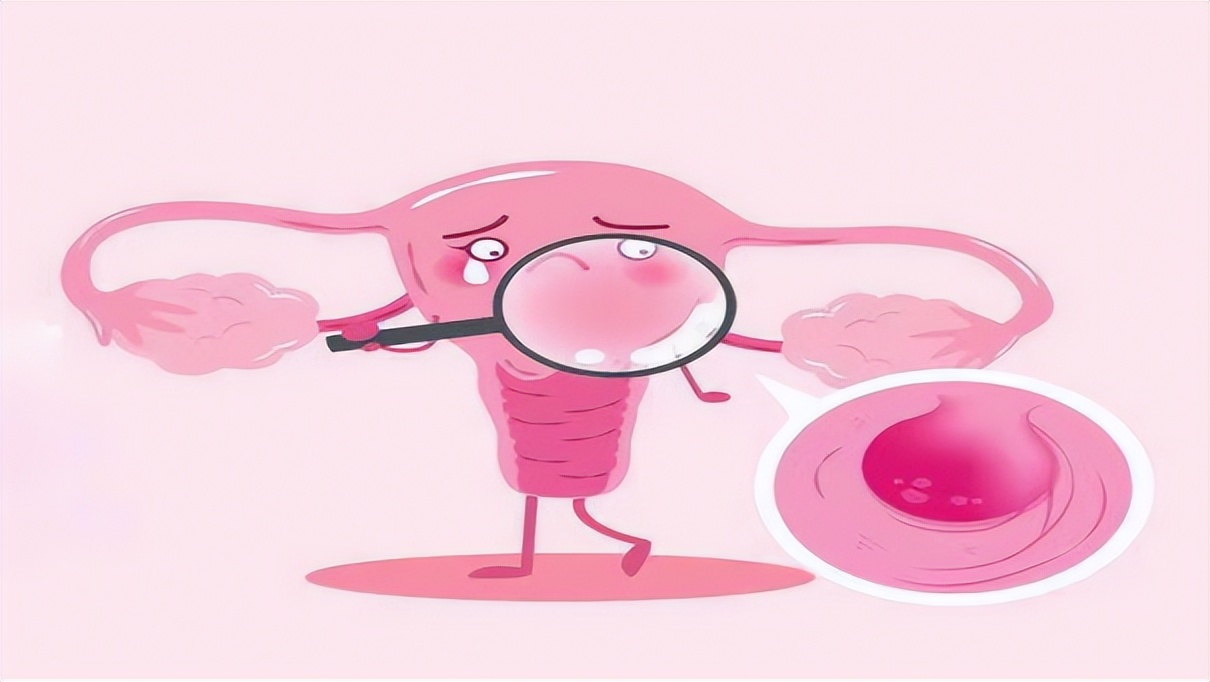 内裤上面很黄是妇科炎症吗,妇科裤头总是黄的是得了什么病