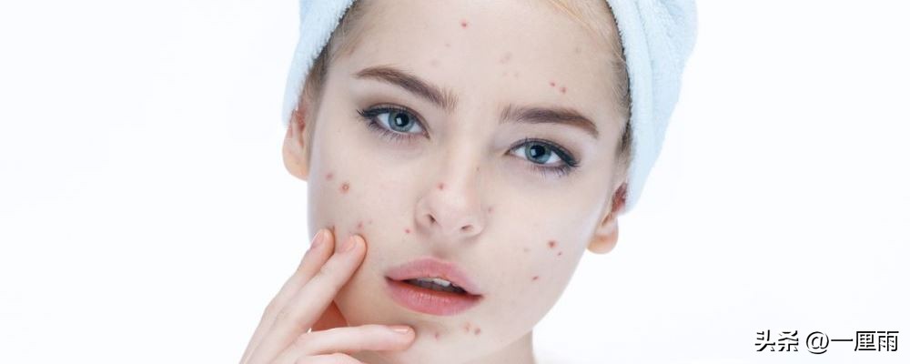 祛痘痘最快的方法不留痘印,怎么祛痘痘和痘印最有效的方法