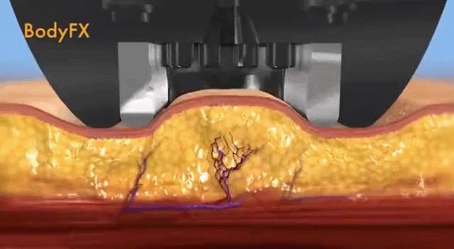 刘雯高级感,刘雯的脸型适合的风格