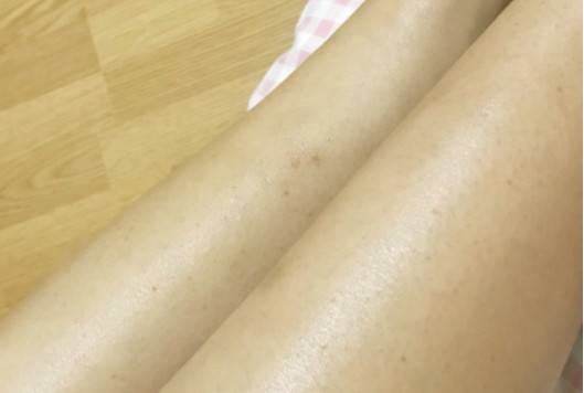 孕期护肤品澳兰黛,孕期用澳兰黛皮肤刺痛