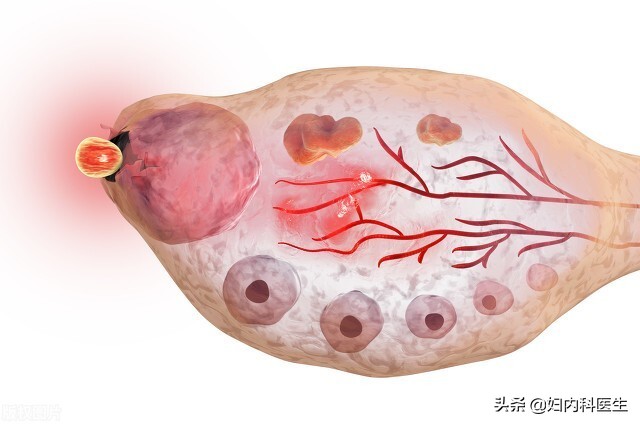 月经每次来一两天就完了怎么回事,月经干净两天肚子开始疼怎么回事