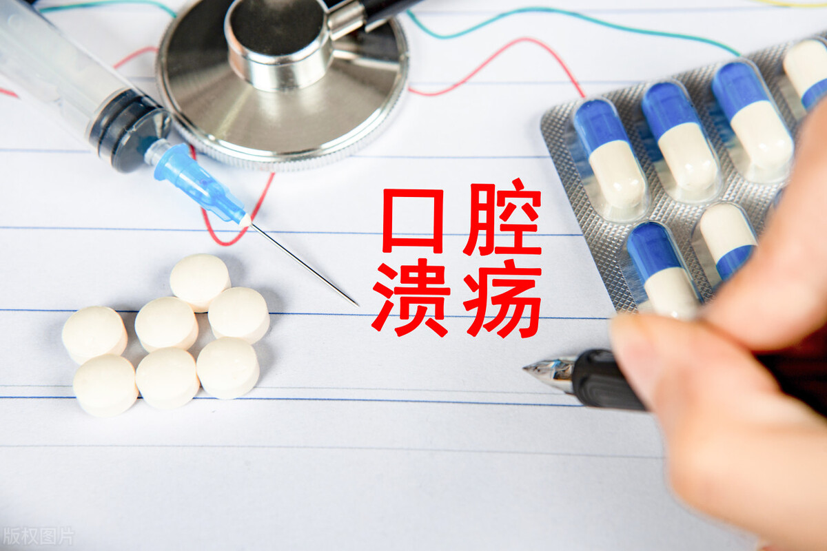 口腔溃疡癌变怎么能看出早期晚期,口腔溃疡癌变早期症状的治疗方法