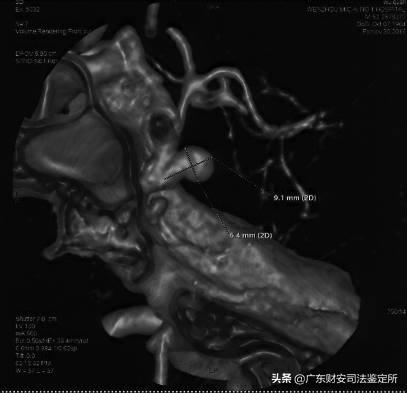 脑部神经损伤司法鉴定需要做哪些,司法鉴定颅内出血是轻伤还是重伤