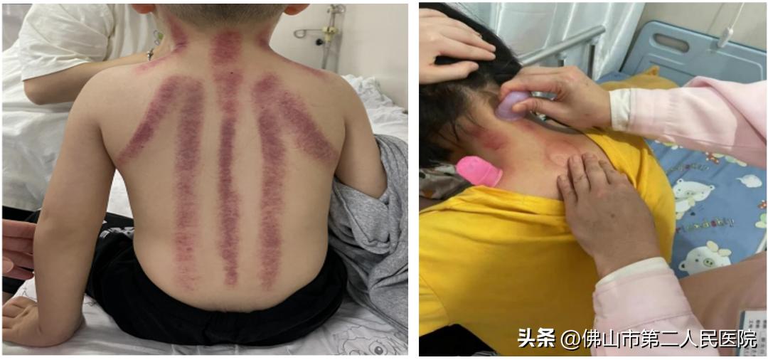 小孩长得比同龄矮需要做什么检查,父母矮孩子多大看生长发育科