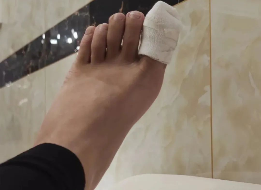 马桶侧排漏水换密封圈,马桶往楼下漏水换蹲便器可以吗