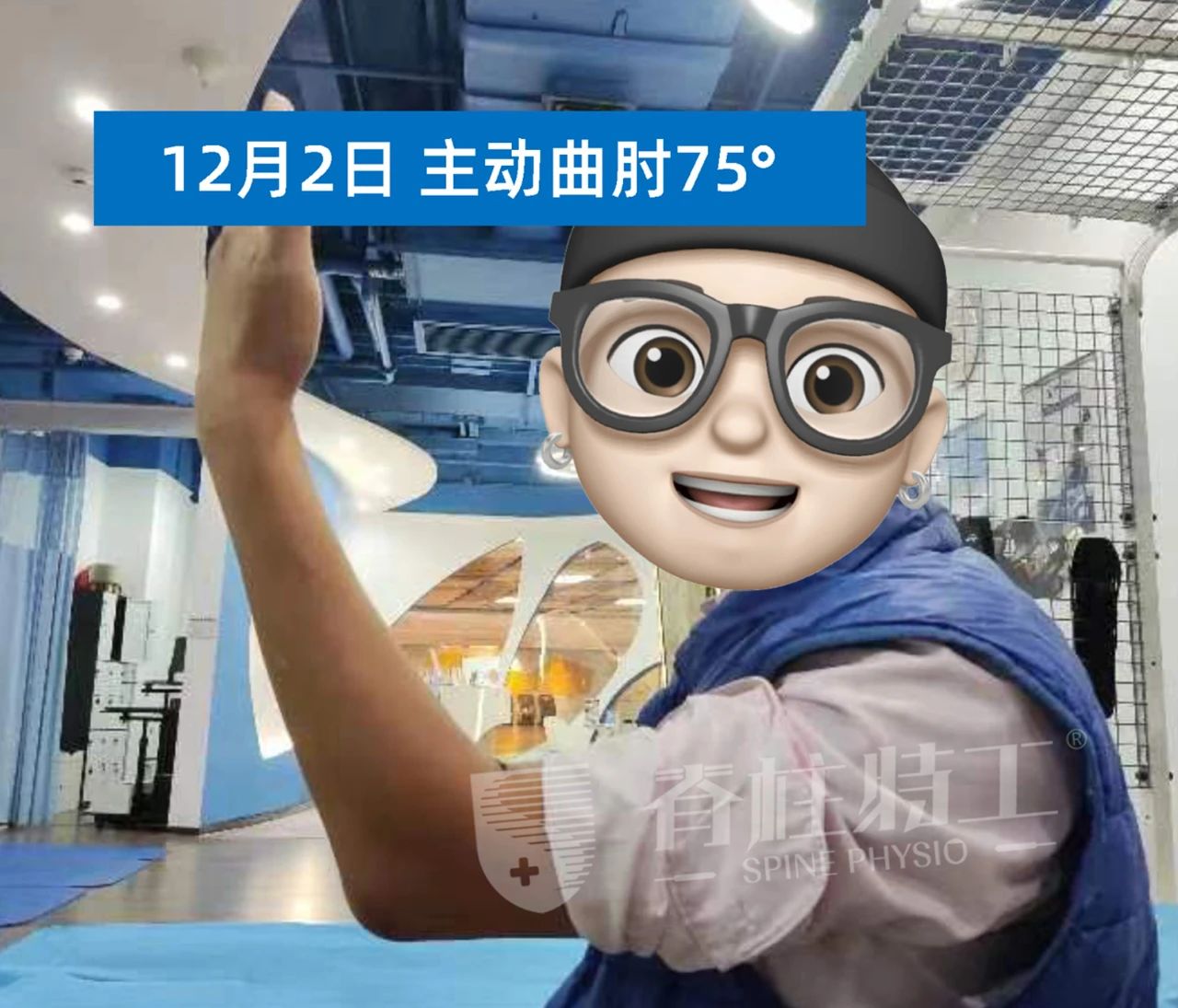 手肘骨折术后肿胀多久会完全消除,手肘骨折恢复后手僵硬康复治疗