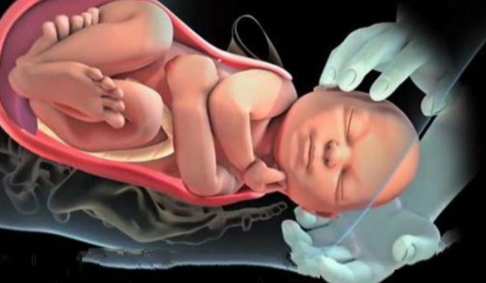 顺产时，为什么是胎儿的“头”先出来而不是脚呢？原因挺有意思