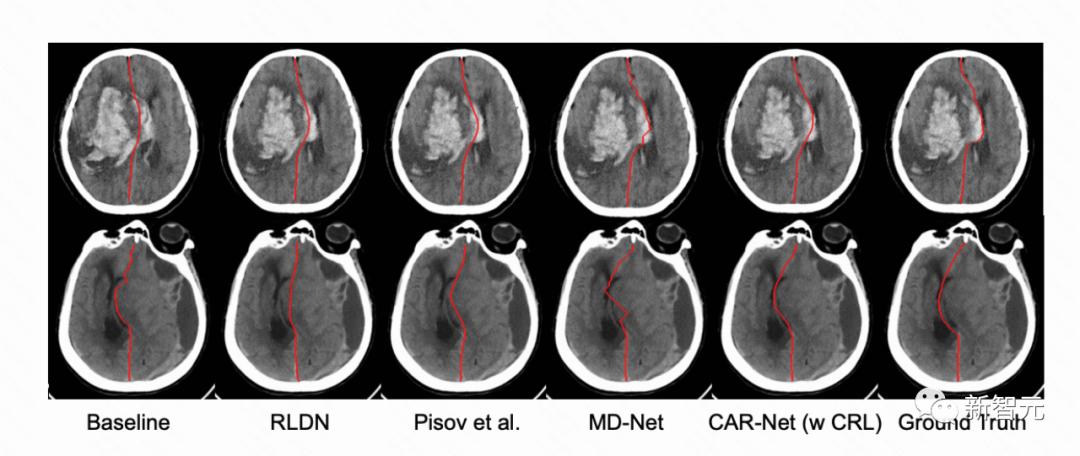 初代95后,「闯」进大厂搞技术