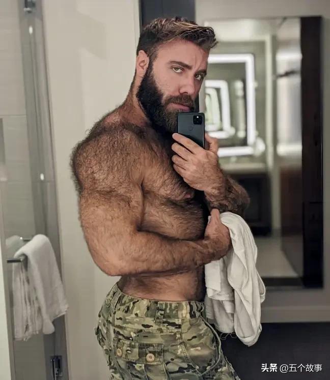 男子体毛生长太快,并随着季节而变化,自称泰迪熊