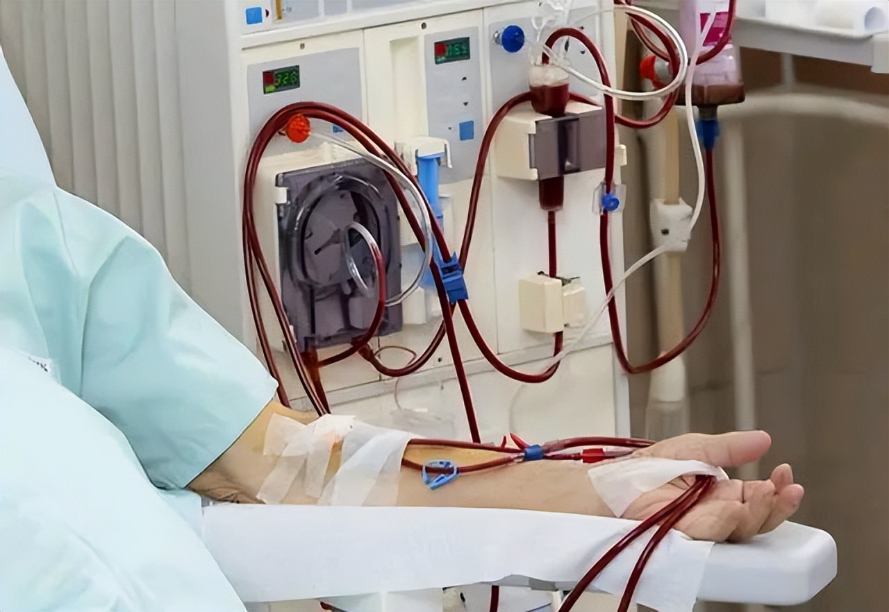 血液透析球囊扩张术,透析患者球囊扩张成型术