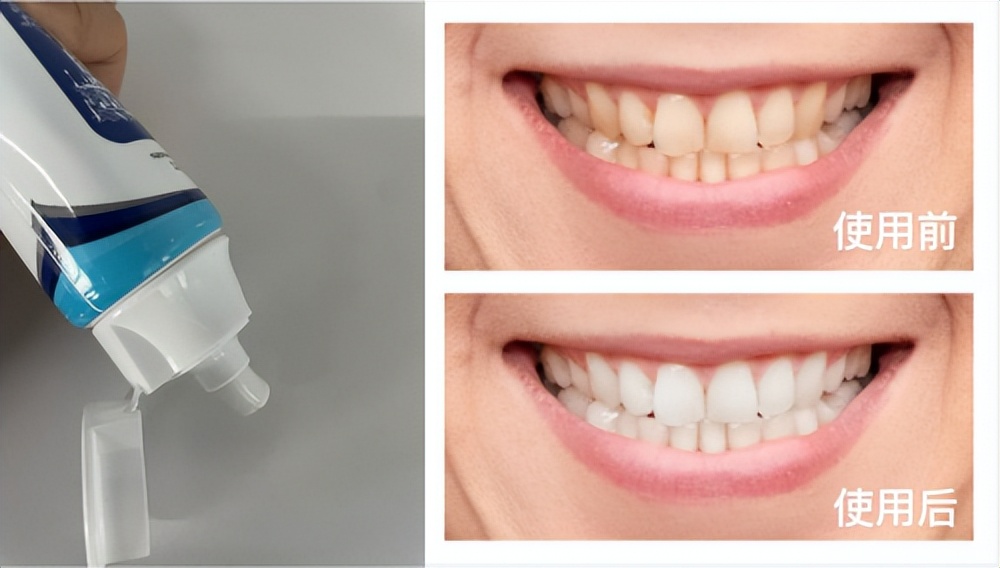 十几款牙膏品牌实验对比,牙膏选哪一款好呢