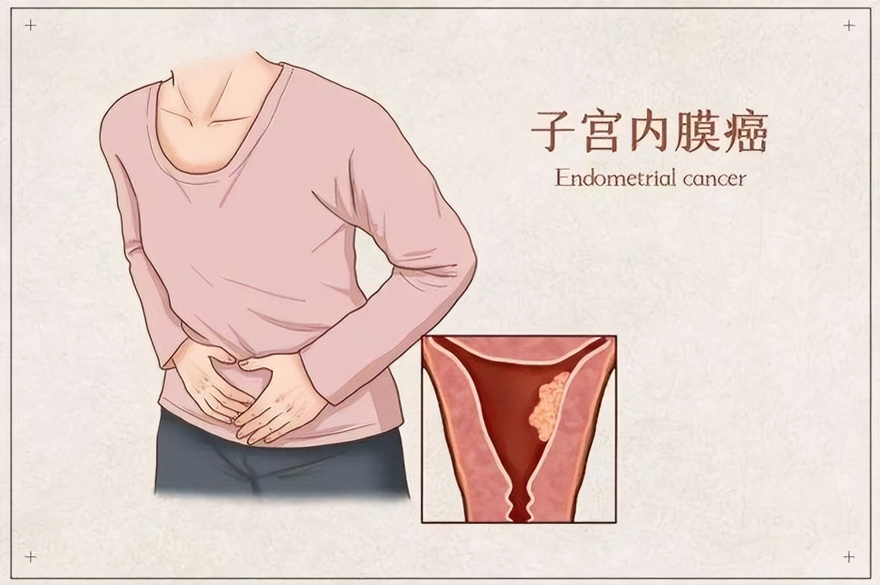 女人倒开花是什么病,60岁女性倒春花是咋回事