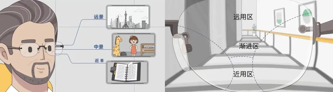 40多岁得了老花眼?!别慌!激光矫治让你“返老还童”