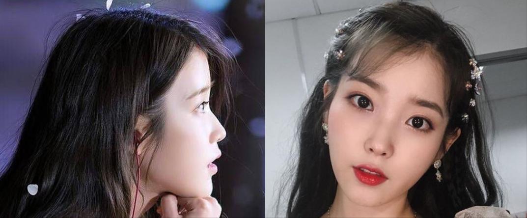 为什么大部分亚洲人都是扁头,正脸好看但侧脸丑到爆怎样办