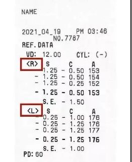 一秒钟教你学会验光条,一分钟教你看懂验光检查结果
