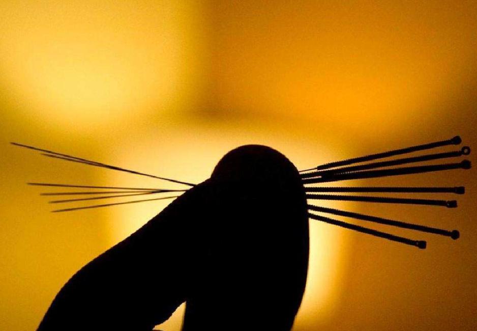 中医无痛治疗?芒针治疗中风后的寒热错杂型消化不良疗效相关研究