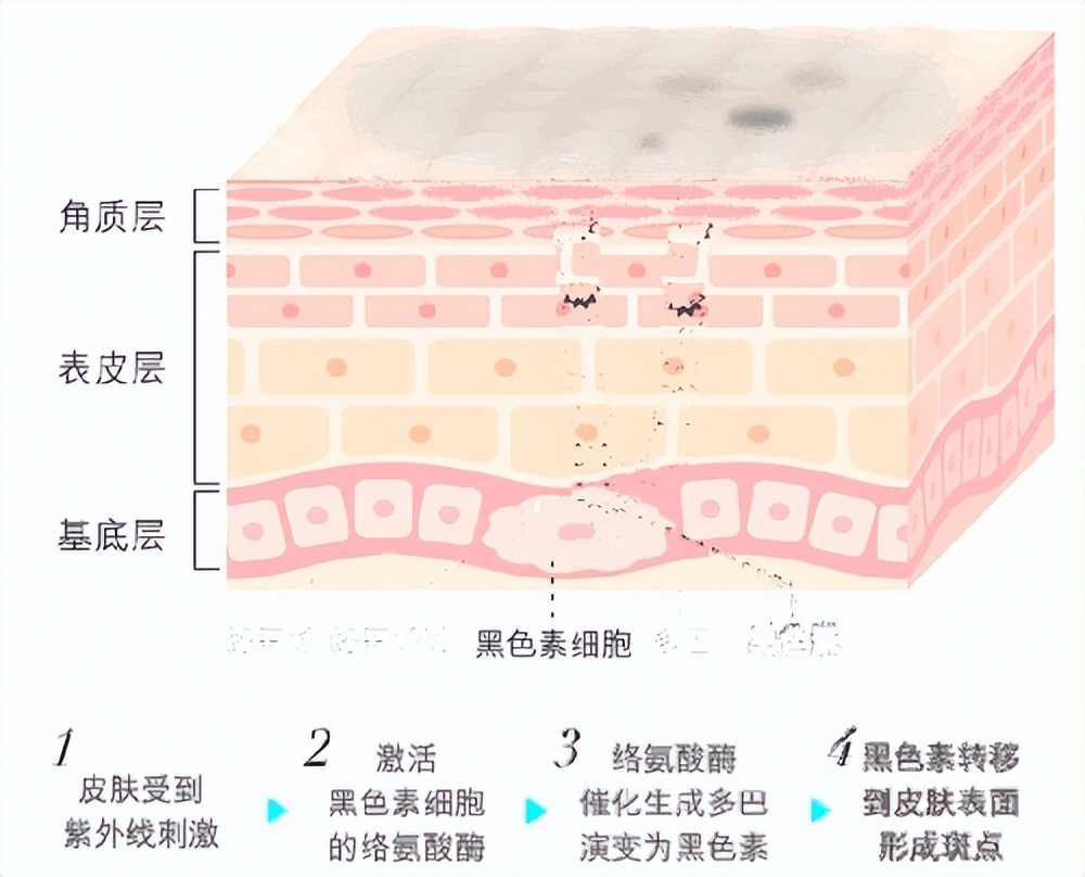 芮一美白淡斑面膜,泰国芮一ray维生素面膜