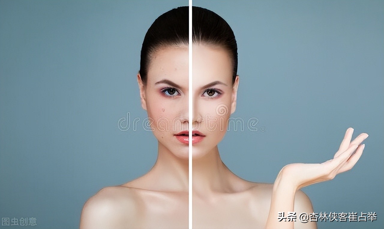 祛各种斑有什么药方,中药淡斑消斑的最好方法