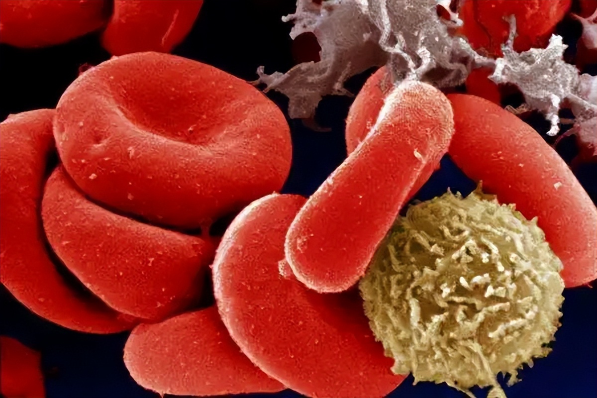 泡发黑木耳多长时间会中毒,黑木耳不能长时间泡辟谣