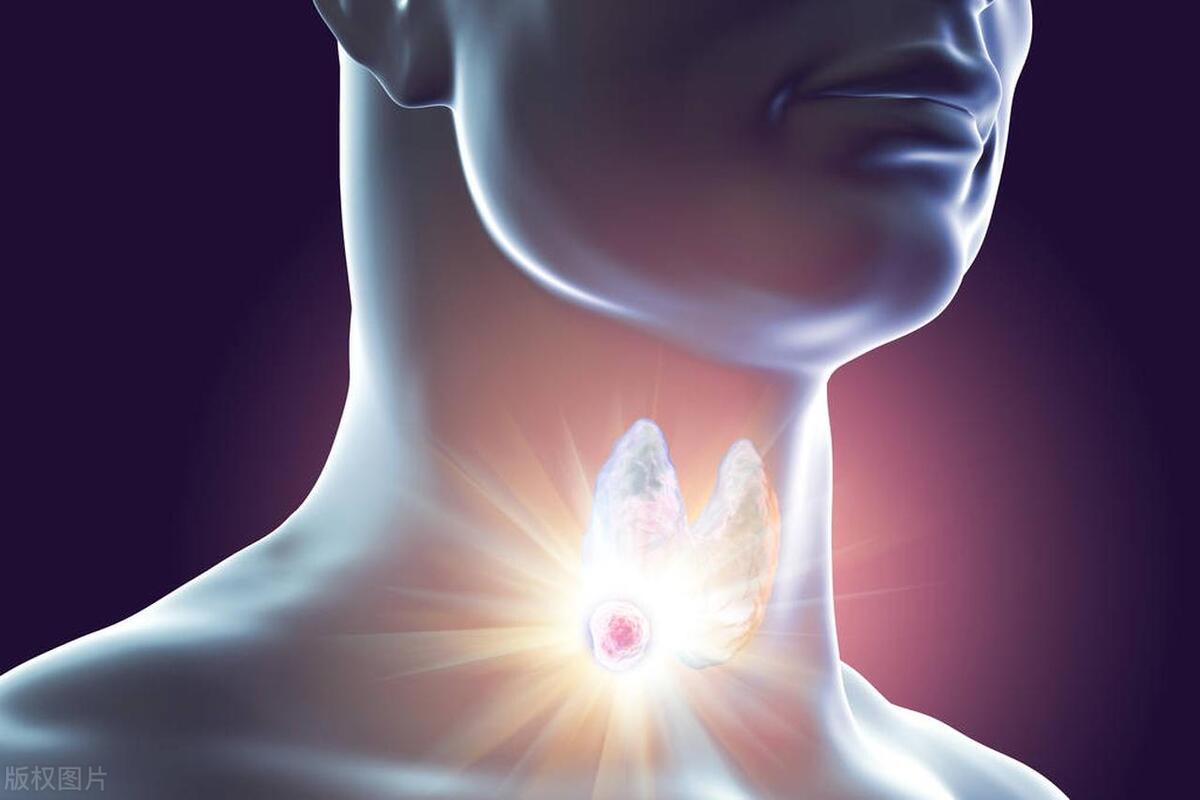 4a类甲状腺结节要吃药吗,4a类甲状腺结节有什么反应