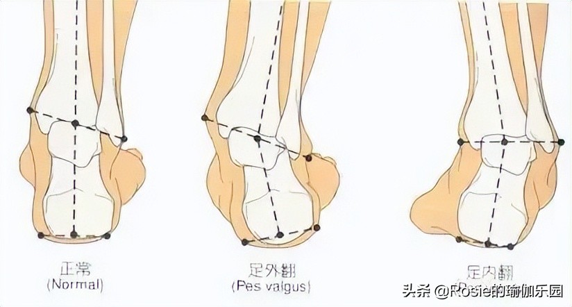 vivi练操前后对比,vivi臀部训练一个月