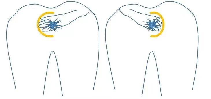 99%的人都不会正确擦屁股,带薪拉屎必看!