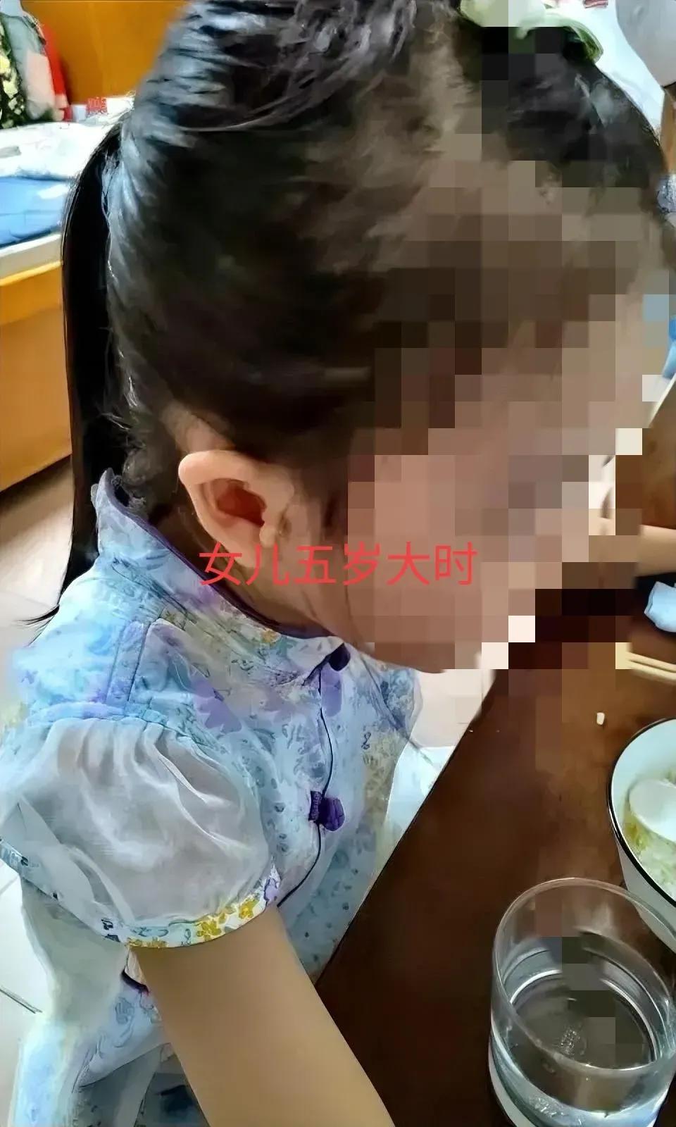 耳朵旁为什么长了小肉球,右耳旁有个凸起的东西