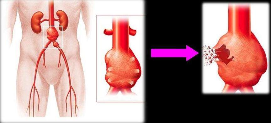 腹痛伴有排气频繁腰痛,非经期腹痛腰疼