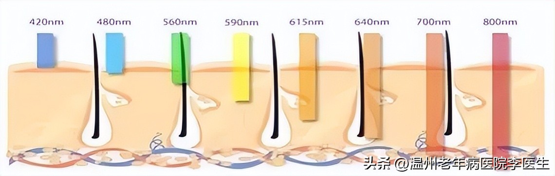 光子嫩肤真的嫩肤吗,美白嫩肤光子