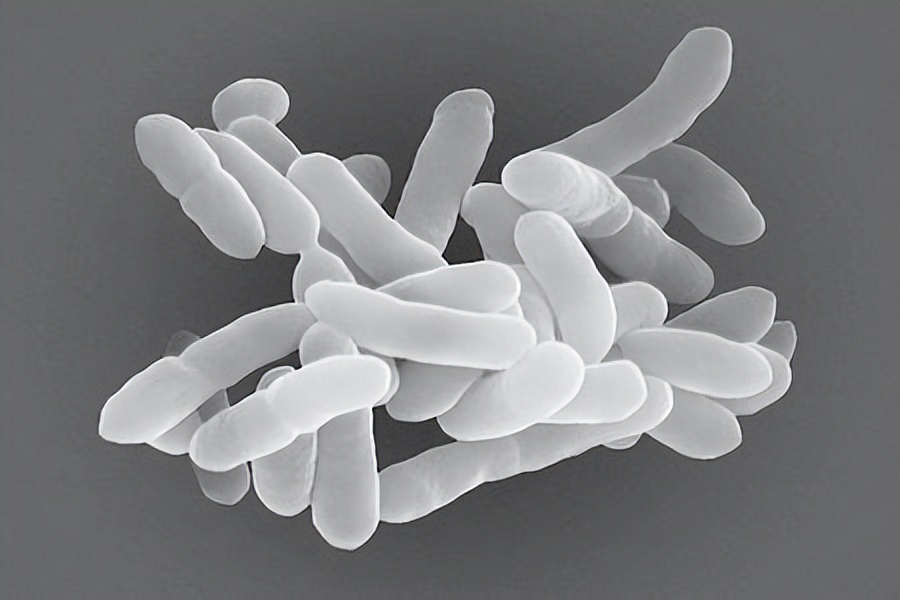 肺部积累痰液多久会产生病变,痰液粘稠带血是肺癌吗