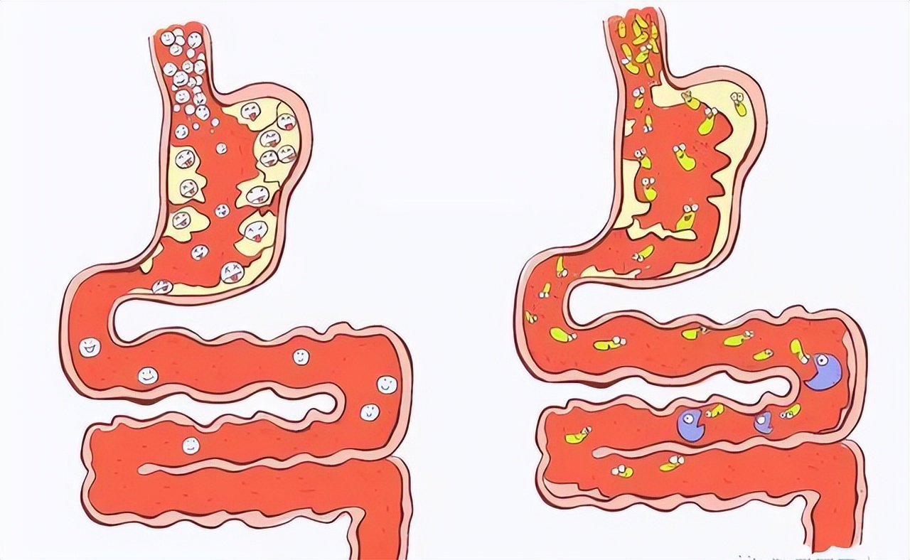结肠息肉切除止血有哪些方法,直肠息肉切除术止血方法