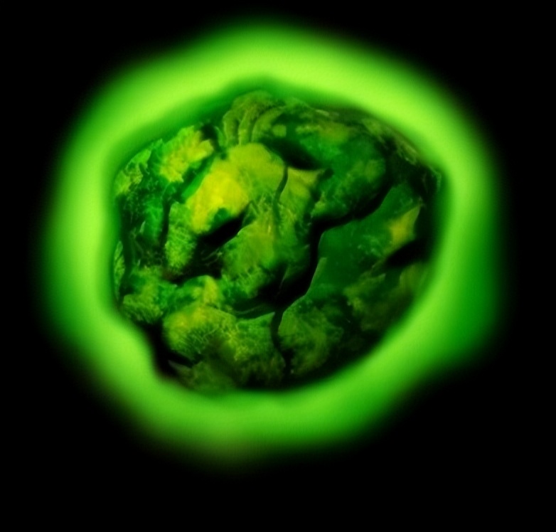 镭辐射多久致死,辐射会杀死所有生物吗