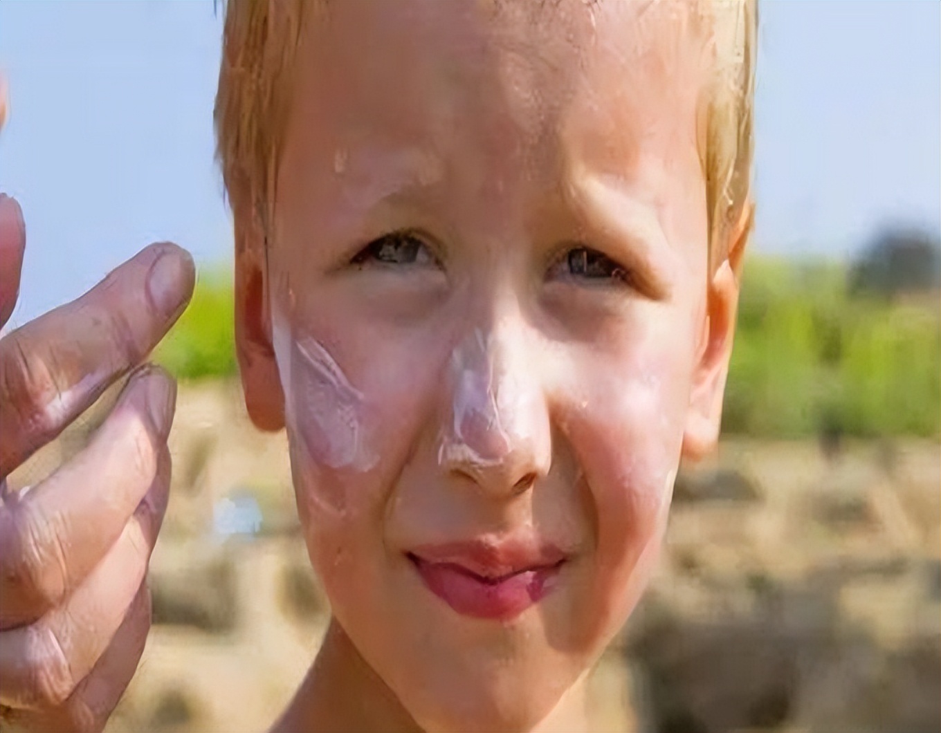 炉甘石万能药,万能止痒软膏配方