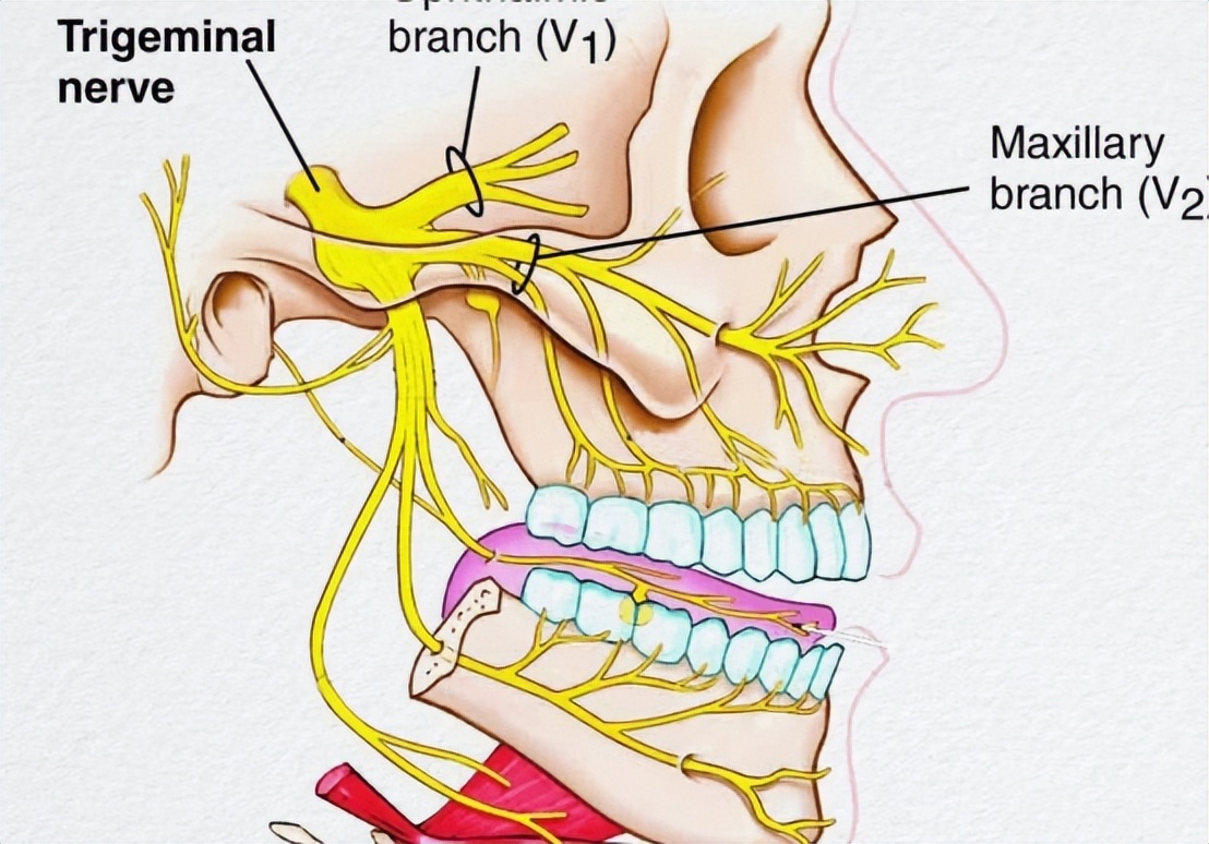 面肌痉挛会不从眼皮开始发病吗,什么是面肌痉挛该如何治疗