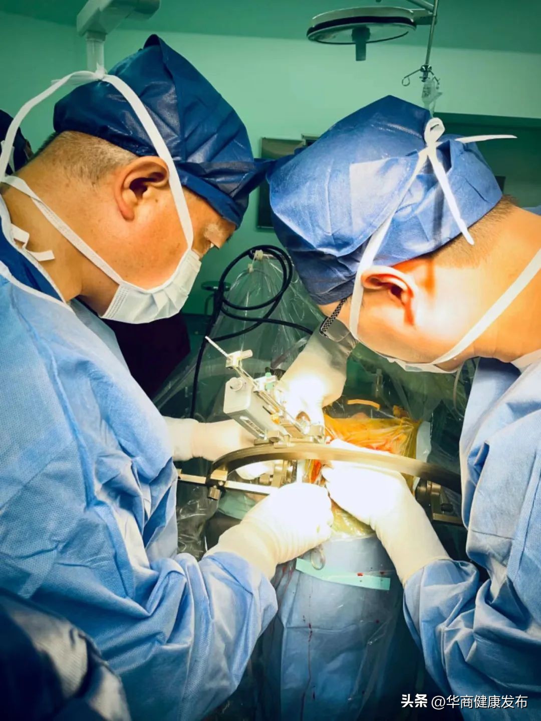 帕金森dbs手术后的真实写照,帕金森dbs手术后5年的真实生活