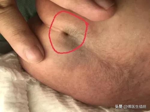 孩子6岁了老是尿床怎么办,男孩4岁尿床脊椎裂